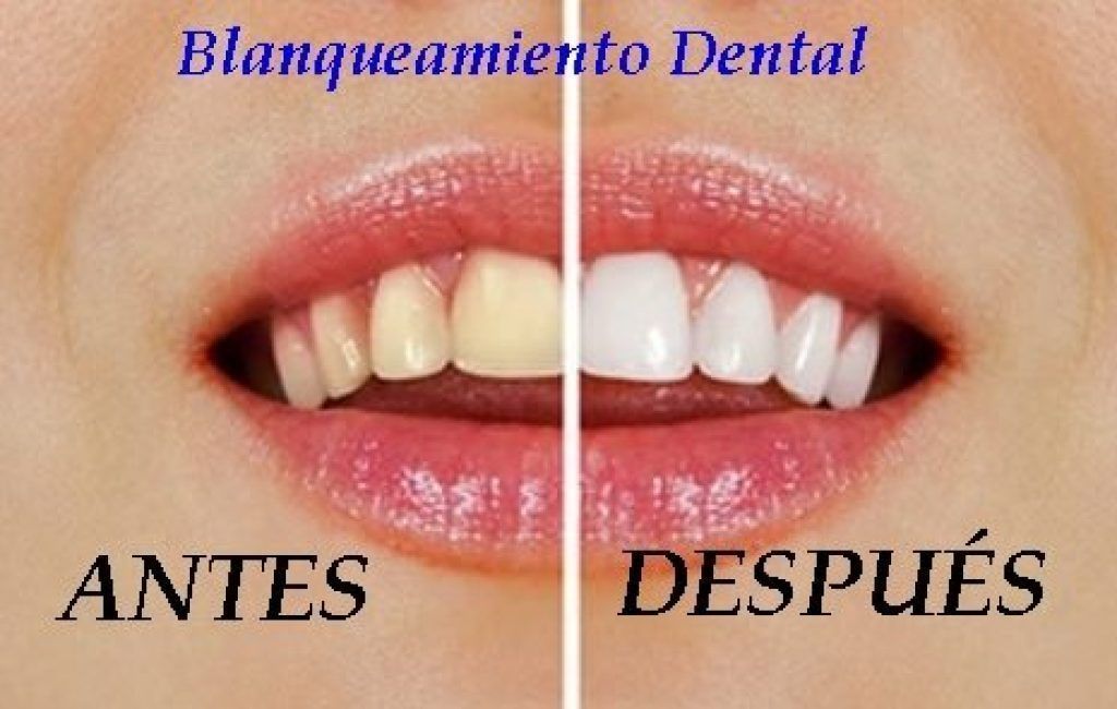 Blanqueador Dental Premium